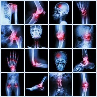 What is Chronic Inflammation? Signs, Causes & Treatments